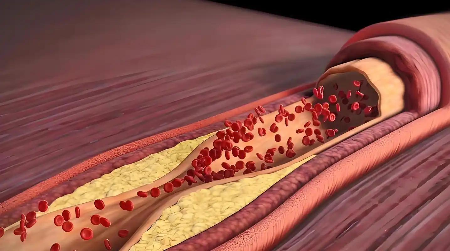 三种茶叶降血脂最快