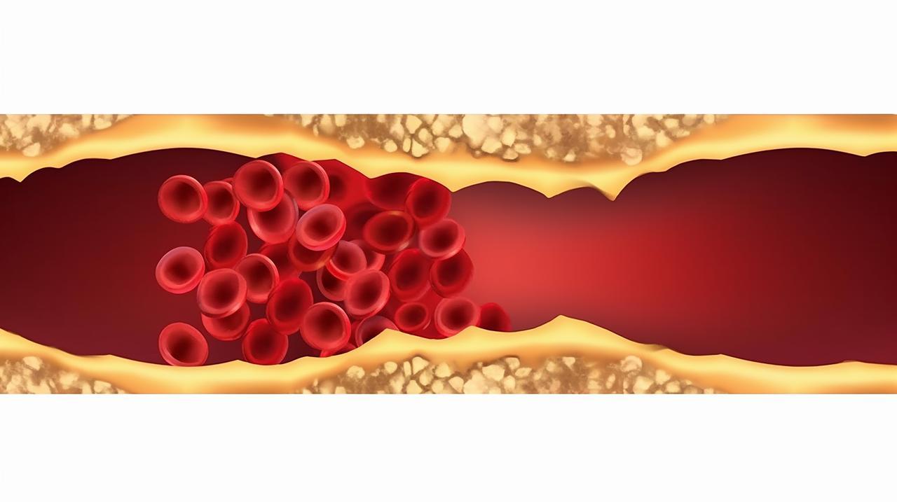 三种茶叶降血脂最快