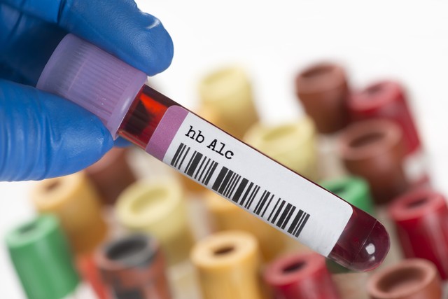 三种茶叶降血脂最快